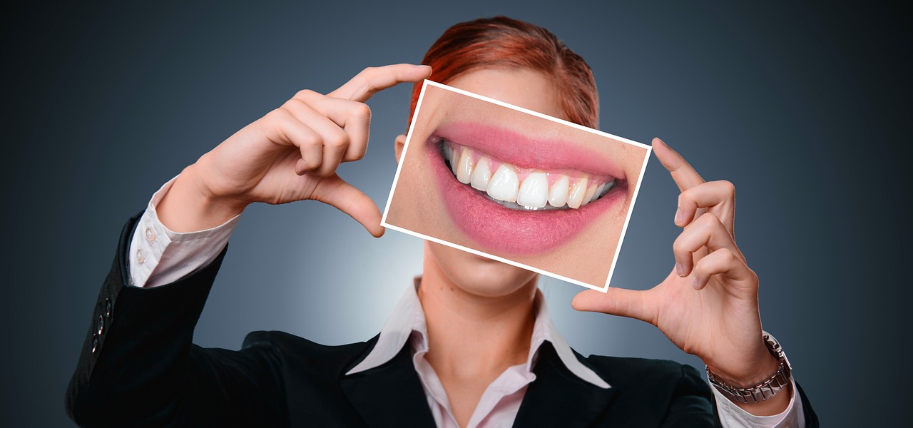 Ankara Invisalign tedavisi
